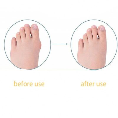 TPR Volwassenen Grote Voet Straightener Bunion Correctie Dag/Nacht Kinderen Duim Toe Straightener Voor Schoenen